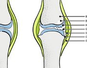 Artrose van heup en knie in de eerste lijn
